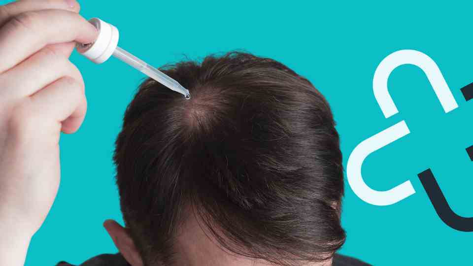 Best shampoo for hair loss for male pattern baldness.
