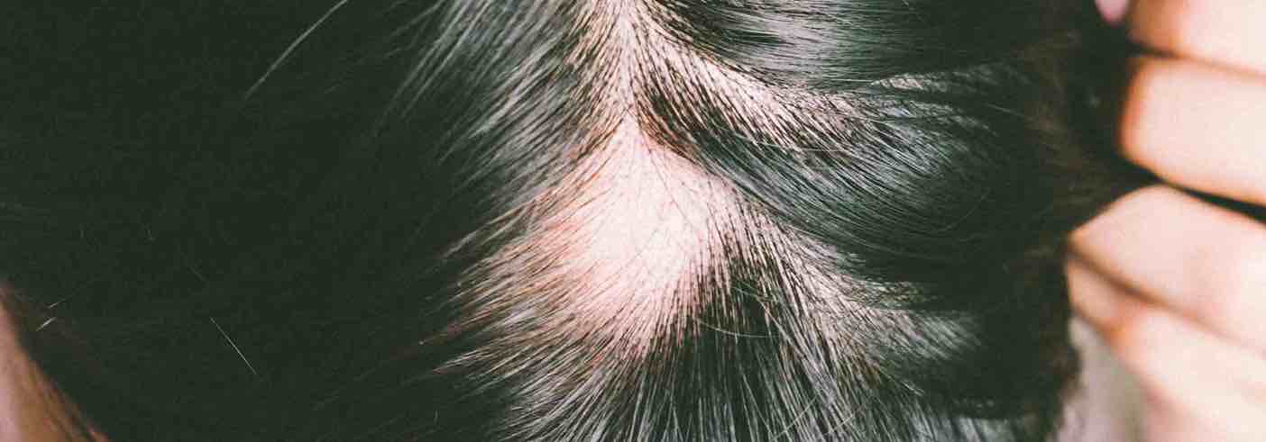 Can I stop manual hair loss?
