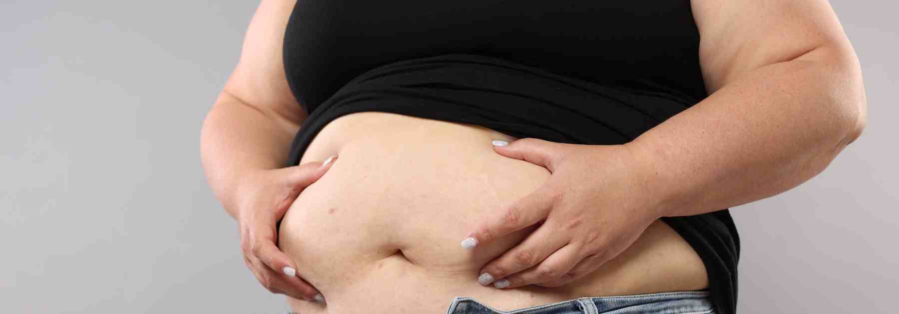 Weight management: NHS vs private services